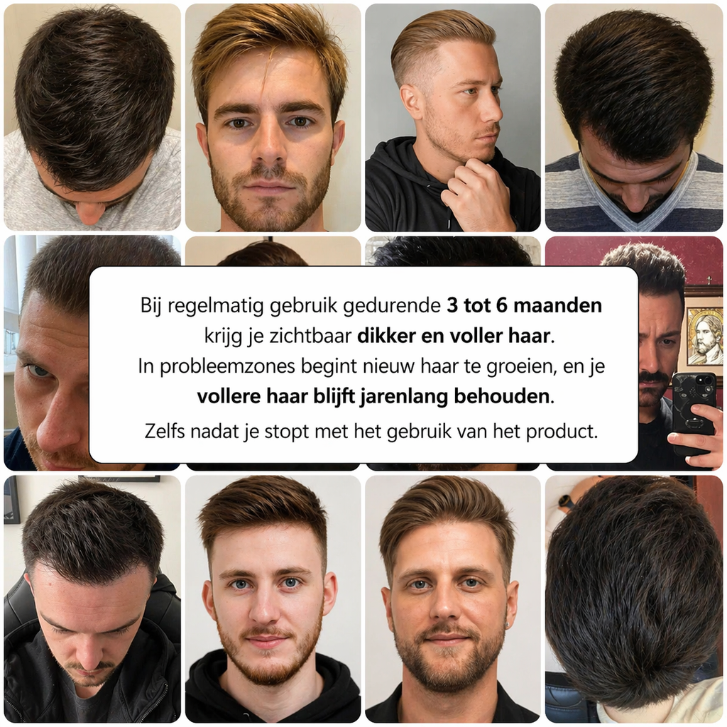 Hairox™ | APEX HAARGROEI SYSTEEM